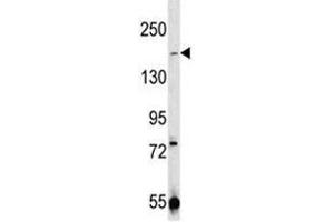 Image no. 5 for anti-Transient Receptor Potential Cation Channel, Subfamily M, Member 7 (TRPM7) (AA 1821-1850) antibody (ABIN3029239)