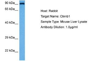Image no. 1 for anti-Catenin (Cadherin-Associated Protein), beta 1, 88kDa (CTNNB1) (C-Term) antibody (ABIN2792303)