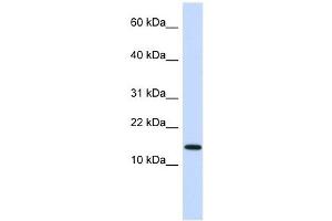 Image no. 3 for anti-Non-Metastatic Cells 1, Protein (NM23A) Expressed in (NME1) (N-Term) antibody (ABIN926849)