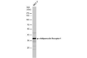 Image no. 2 for anti-Adiponectin Receptor 1 (ADIPOR1) (C-Term) antibody (ABIN2855945)