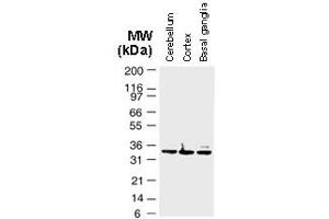 Image no. 2 for anti-BCL2-Associated Athanogene (BAG1) (AA 26-45) antibody (ABIN957141)