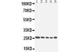Image no. 1 for anti-Homeobox A6 (HOXA6) (AA 95-114), (Middle Region) antibody (ABIN3043152)