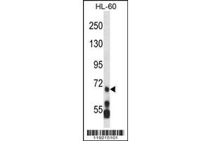 Image no. 1 for anti-Myeloid/lymphoid Or Mixed-Lineage Leukemia 5 (Trithorax Homolog) (MLL5) (AA 93-120), (N-Term) antibody (ABIN658094)
