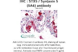 Image no. 2 for anti-Syntaxin 5 (STX5) (AA 1-101) antibody (ABIN1723527)