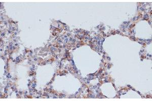Immunohistochemistry of paraffin-embedded Rat lung using CD40 Polyclonal Antibody at dilution of 1:200 (40x lens).