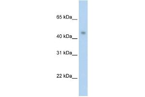 Image no. 1 for anti-Protein Arginine Methyltransferase 8 (PRMT8) (C-Term) antibody (ABIN2778661)