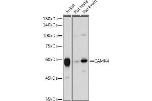 CAMK4 抗体  (AA 304-473)