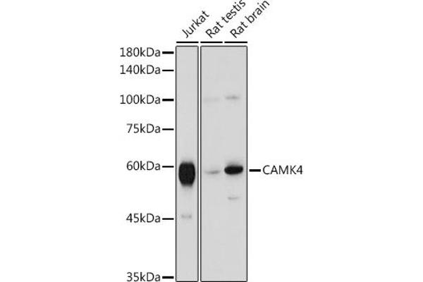 CAMK4 Antikörper  (AA 304-473)
