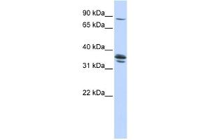 anti-Solute Carrier Organic Anion Transporter Family, Member 3A1 (SLCO3A1) (Middle Region) antibody