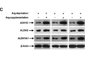 Image no. 10 for anti-Aldehyde Dehydrogenase 1 Family, Member A1 (ALDH1A1) antibody (ABIN3022573)