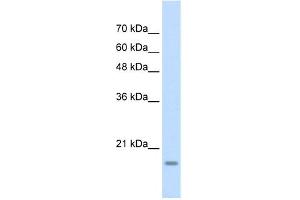 Image no. 1 for anti-YY1 Associated Factor 2 (YAF2) (Middle Region) antibody (ABIN2777311)