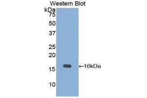 Image no. 1 for anti-Keratin 15 (KRT15) (AA 274-399) antibody (ABIN1172997)