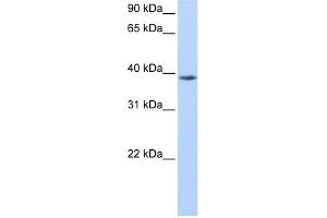 NUDT13 anticorps