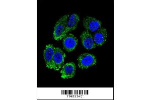Image no. 1 for anti-Arginyl-tRNA Synthetase (RARS) (AA 605-634), (C-Term) antibody (ABIN655043)
