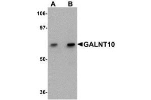 Image no. 2 for anti-UDP-N-Acetyl-alpha-D-Galactosamine:polypeptide N-Acetylgalactosaminyltransferase 10 (GalNAc-T10) (GALNT10) (C-Term) antibody (ABIN499865)