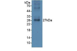 Image no. 2 for C-Reactive Protein (CRP) ELISA Kit (ABIN6574220)