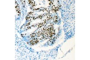 Image no. 1 for anti-Host Cell Factor C1 (VP16-Accessory Protein) (HCFC1) (N-Term) antibody (ABIN2707545)