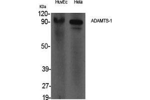 Image no. 2 for anti-ADAM Metallopeptidase with Thrombospondin Type 1 Motif, 1 (ADAMTS1) (Internal Region) antibody (ABIN3183173)