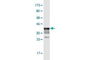 Image no. 4 for anti-Lysine (K)-Specific Demethylase 5D (KDM5D) (AA 127-230) antibody (ABIN2565646)