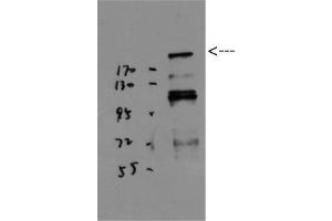 Western Blot (WB) analysis of JK using BRCA1 Polyclonal Antibody diluted at 1:1000.