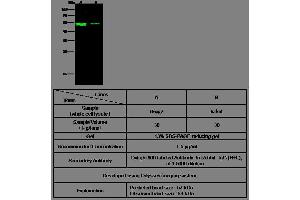 Image no. 1 for anti-Interferon alpha/beta Receptor 2 (IFNAR2) (AA 1-243) antibody (ABIN2649212)