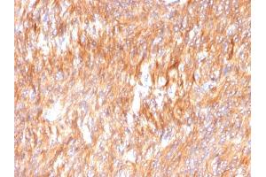 Image no. 5 for anti-Calnexin (CANX) (AA 1-300), (N-Term) antibody (ABIN6940952)