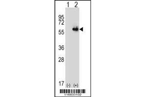 Western Blotting (WB) image for anti-Aldehyde Dehydrogenase 4 Family, Member A1 (ALDH4A1) (Center) antibody (ABIN2159055)