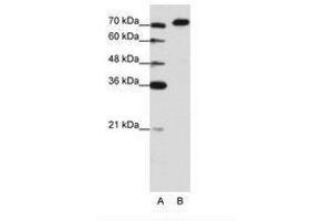Image no. 3 for anti-A Kinase (PRKA) Anchor Protein 8-Like (AKAP8L) (C-Term) antibody (ABIN202849)