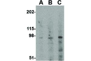 Image no. 1 for anti-Glutamate Receptor, Ionotropic, Kainate 5 (GRIK5) (C-Term) antibody (ABIN6656212)