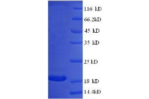 Image no. 1 for Interferon, alpha 14 (IFNa14) (AA 24-189) protein (GST tag) (ABIN5709713)