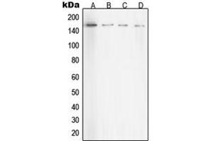 Image no. 2 for anti-rho-Associated, Coiled-Coil Containing Protein Kinase 1 (ROCK1) (Center) antibody (ABIN2706968)