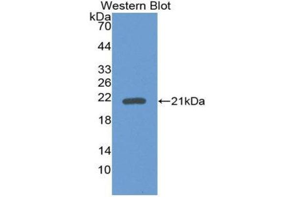 anti-Growth Differentiation Factor 2 (GDF2) (AA 241-418) antibody