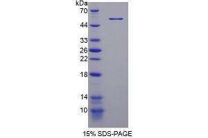 Image no. 1 for phosphodiesterase 4D, cAMP-Specific (PDE4D) (AA 581-809) protein (GST tag,His tag) (ABIN6237116)