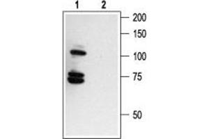 Western blot analysis of human melanoma cells A875: - 1.