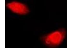 Image no. 1 for anti-Periplakin (PPL) antibody (ABIN2966890)