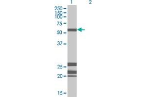 Western Blot analysis of HDAC10 expression in transfected 293T cell line by HDAC10 MaxPab polyclonal antibody.