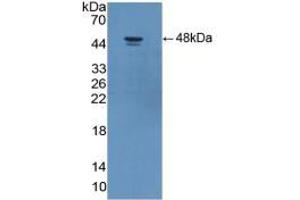 Image no. 5 for Adiponectin Receptor 2 (ADIPOR2) ELISA Kit (ABIN6730916)