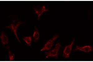 Image no. 2 for anti-Adrenergic, Beta, Receptor Kinase 1 (ADRBK1) antibody (ABIN6259807)