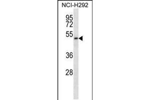 Image no. 1 for anti-Phosphatidylinositol Glycan T (PIGT) (AA 392-421), (C-Term) antibody (ABIN5533522)