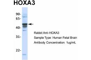 Image no. 2 for anti-Homeobox A3 (HOXA3) (C-Term) antibody (ABIN2775017)