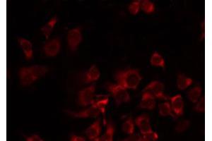 Image no. 1 for anti-Mitochondrial Ribosomal Protein S35 (MRPS35) (N-Term) antibody (ABIN6258510)