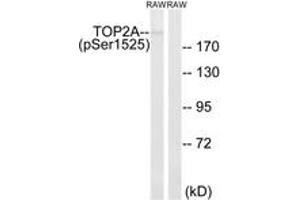 Image no. 1 for anti-Topoisomerase (DNA) II alpha 170kDa (TOP2A) (AA 1482-1531), (pSer1525) antibody (ABIN1532176)