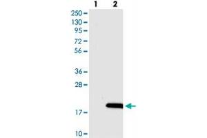 Image no. 2 for anti-Down Syndrome Critical Region Gene 4 (DSCR4) antibody (ABIN5576847)