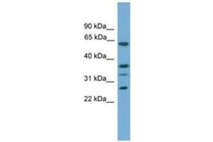 Image no. 1 for anti-Apolipoprotein L, 2 (APOL2) (C-Term) antibody (ABIN6746314)