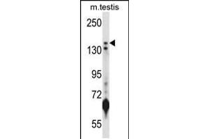 Image no. 1 for anti-Lysine (K)-Specific Demethylase 5B (KDM5B) (AA 192-224), (N-Term) antibody (ABIN5537034)