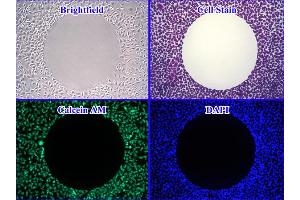 Image no. 3 for Radius™ 24-Well Cell Migration Assay (ABIN2344873)