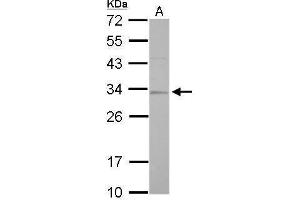 Image no. 4 for anti-Replication Protein A2, 32kDa (RPA2) (Center) antibody (ABIN2856881)
