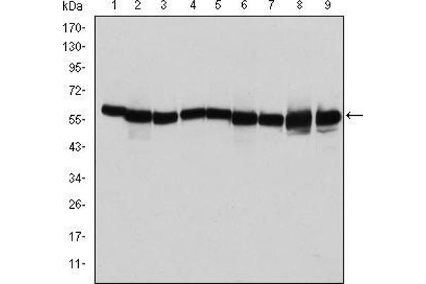 anti-Heat Shock 60kDa Protein 1 (Chaperonin) (HSPD1) antibody