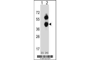 Image no. 1 for anti-Branched Chain Amino-Acid Transaminase 2, Mitochondrial (BCAT2) (AA 309-336), (C-Term) antibody (ABIN656822)