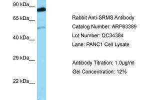 Image no. 1 for anti-Src-Related Kinase Lacking C-Terminal Regulatory Tyrosine and N-Terminal Myristylation Sites (SRMS) (Middle Region) antibody (ABIN2789479)